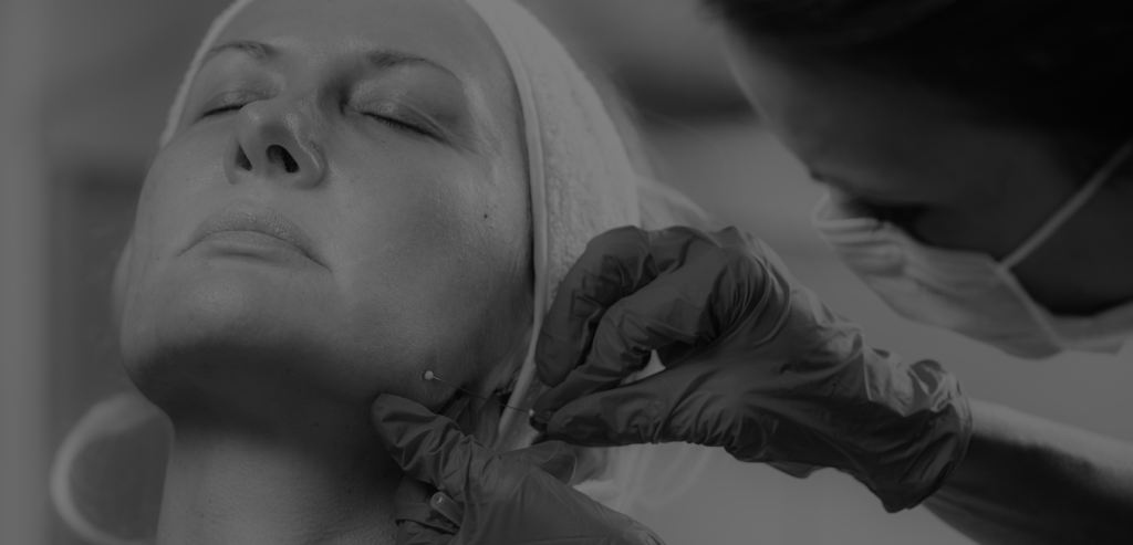 Facial lipofilling