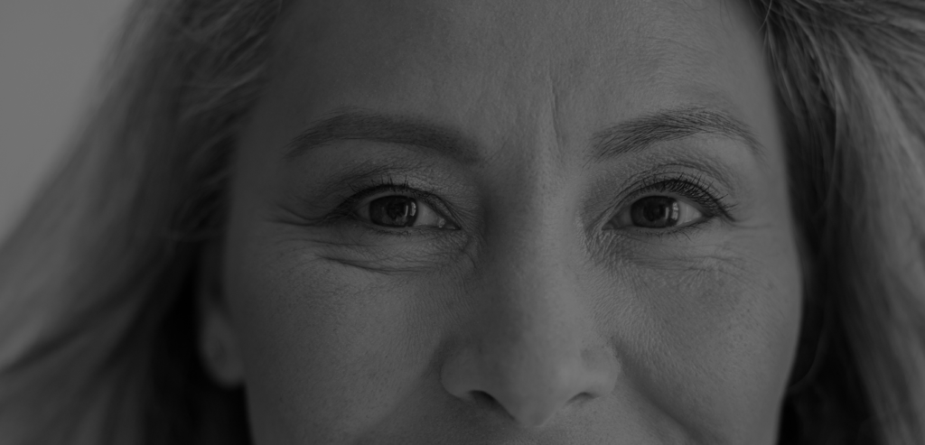 Facial lipofilling
